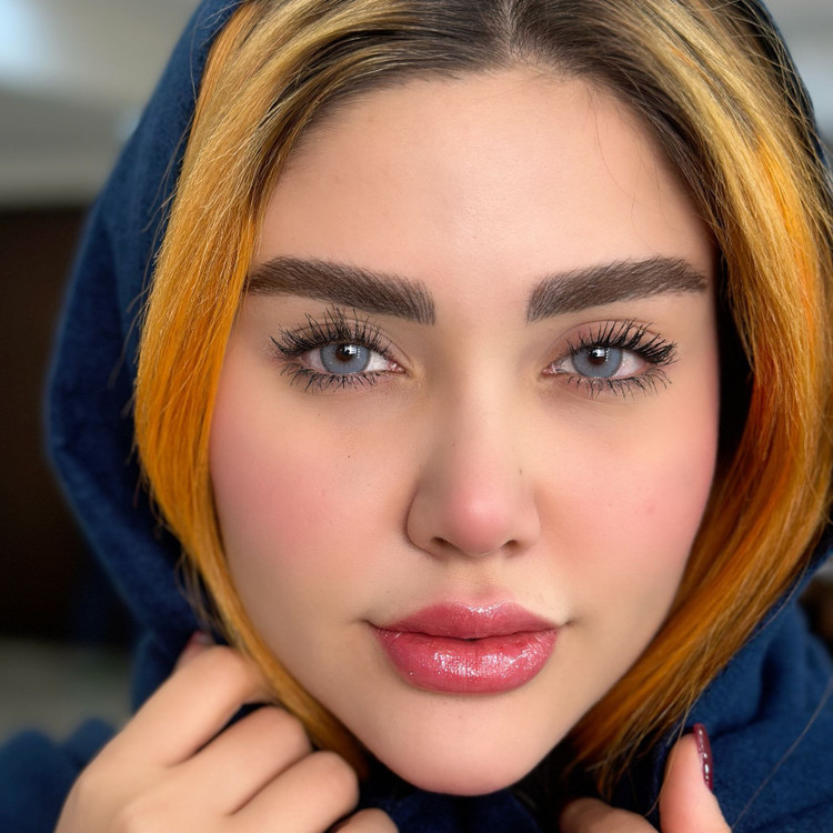 لنز طبی رنگی سالانه آیس کالر
