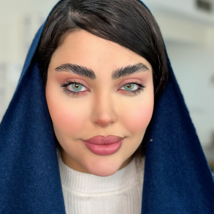 لنز طبی رنگی سالانه آیس کالر